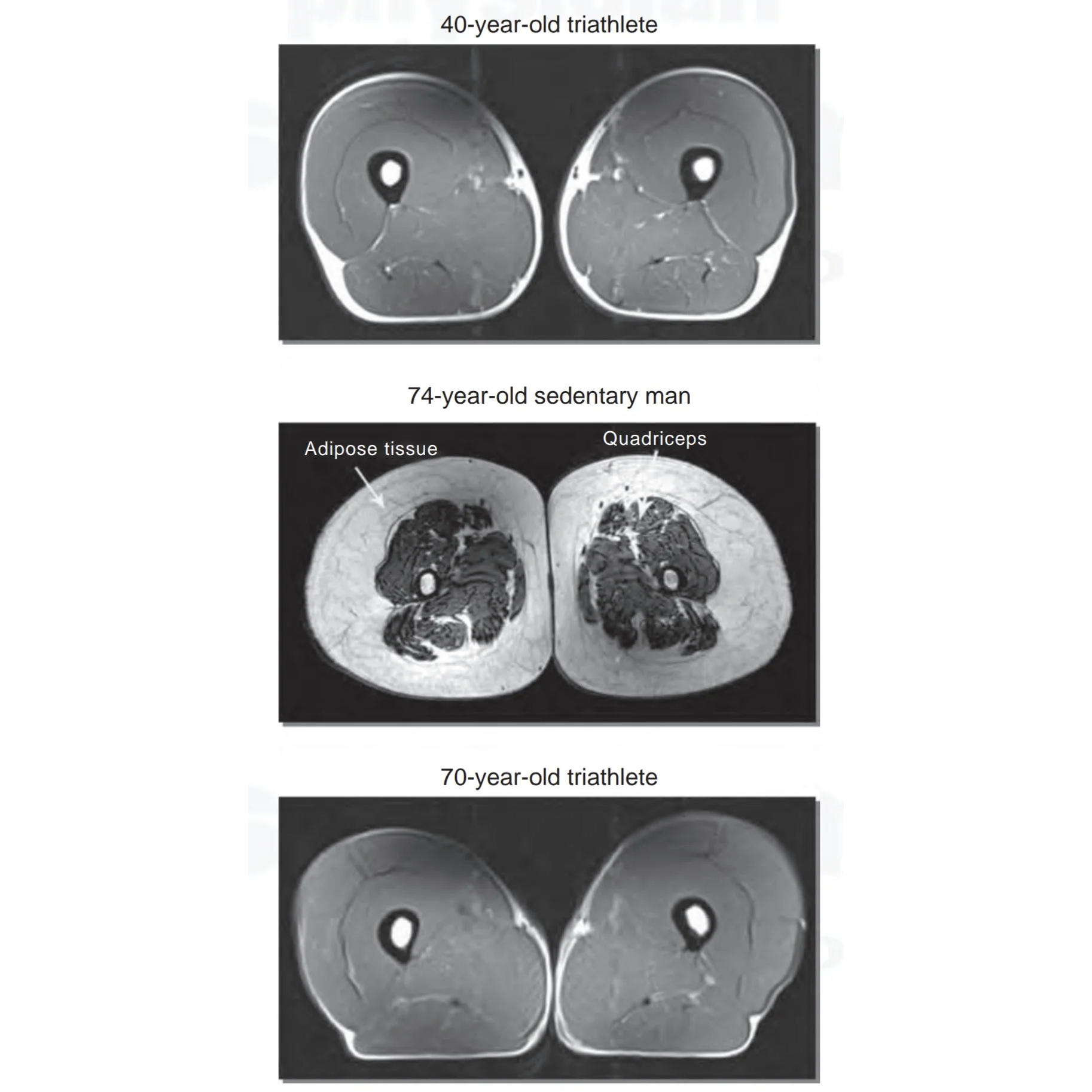 Muskler åldras inte – om du tränar. Här är beviset.